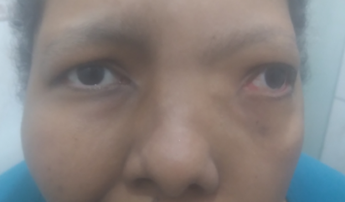 Esperança para Tatiana