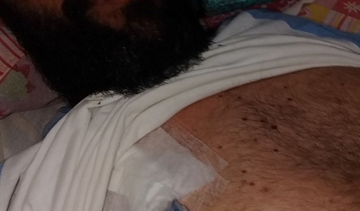 Roupa de mergulho impermeável para um renal crônico