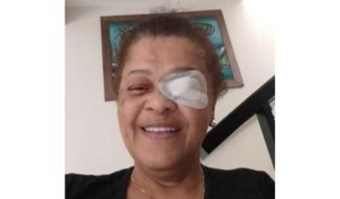 Todos pela Silvana (Pinha)