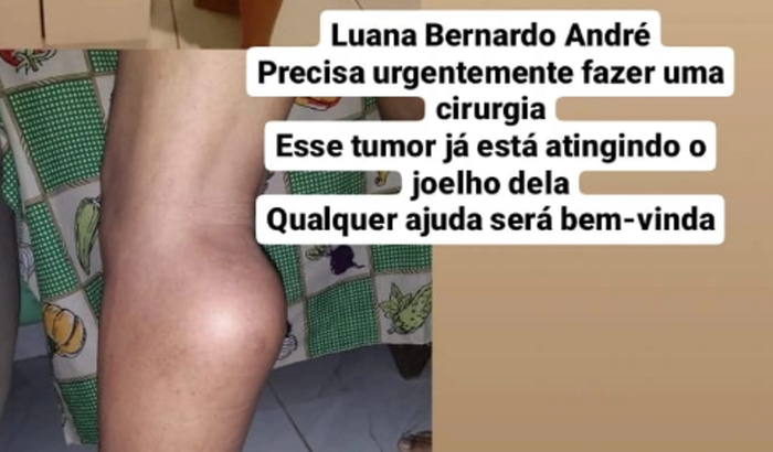 Luana Bernardo André, está com um tumor na perna, e precisa fazer uma cirurgia 