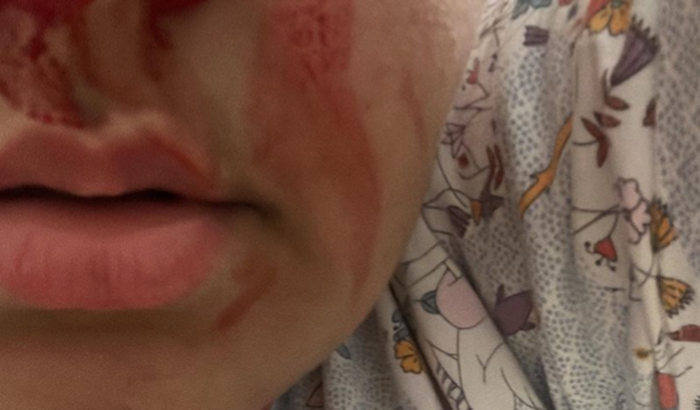 AJUDE A CAROL A CONSEGUIR VIVER!