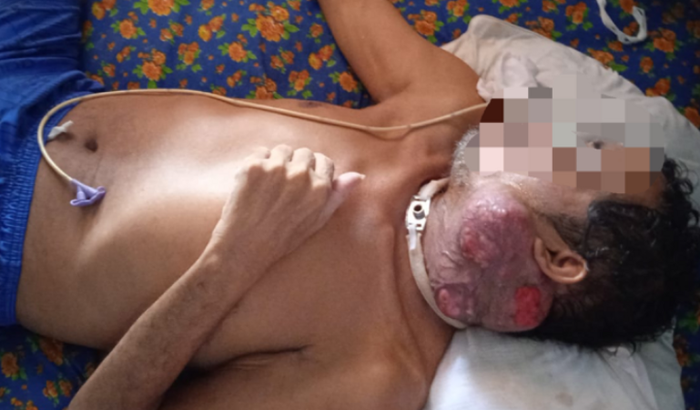 Ajuda no Tratamento Oncológico