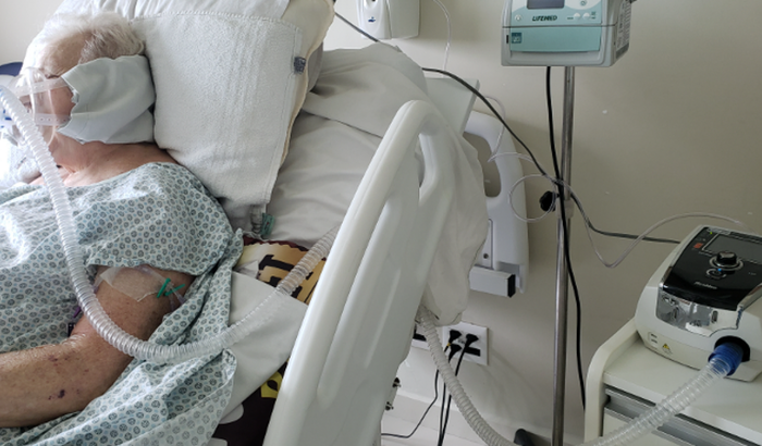 COMPRA RESPIRADOR BPAP / Atelectasia Mieloma