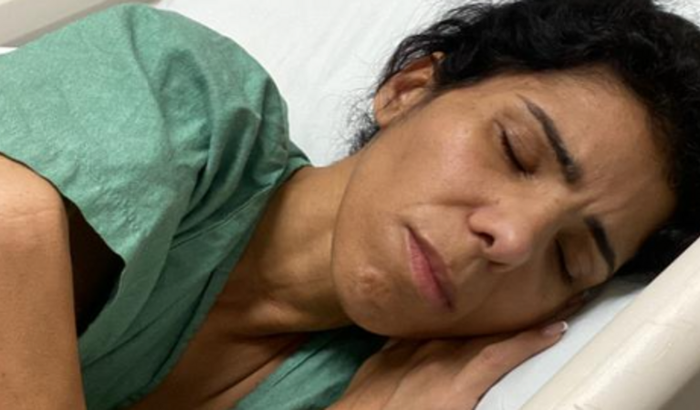 Tratamento de Câncer Estômago