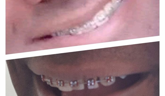 Preciso voltar a sorrir