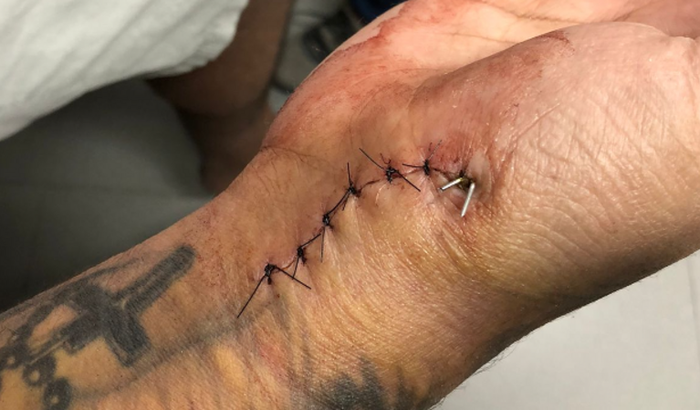 ME AJUDE A NÃO PERDER O MOVIMENTO DO PUNHO.