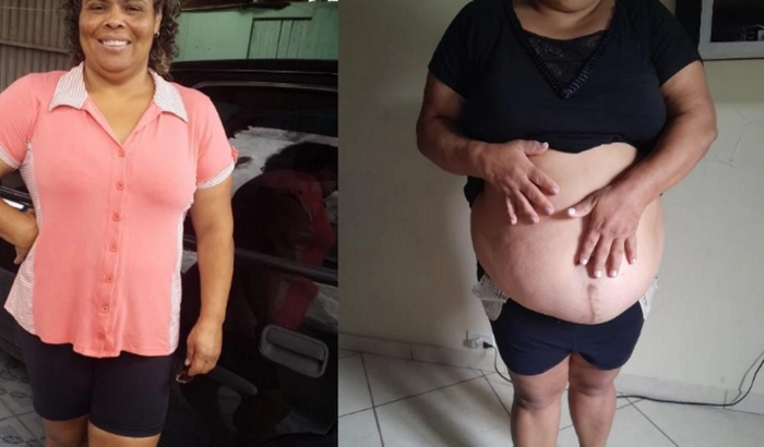 Ajudar a fazer a minha cirurgia.