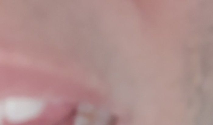 Ajuda meu tratamento bucal