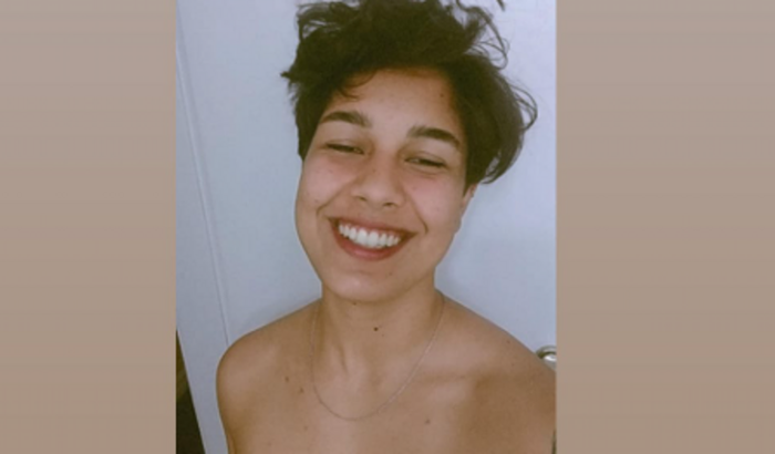 Mastectomia masculinizadora do Micah