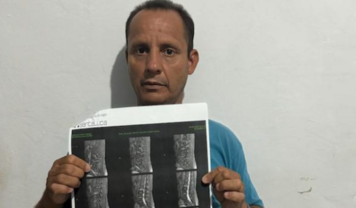 Cirurgia da coluna cervical do Valdir