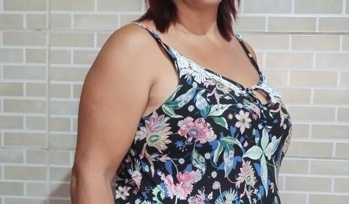 Cirurgia Endometriose Profunda e Endometrioma