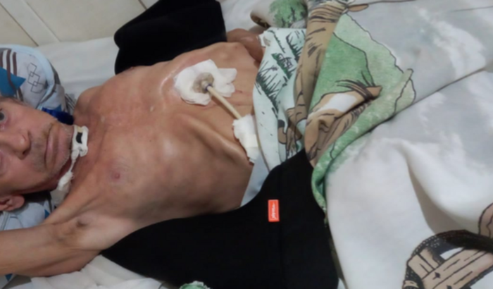 Ajuda no tratamento do senhor Cláudio