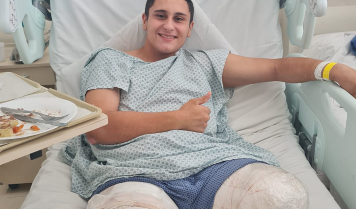 Prótese para perna + custos para reabilitação.