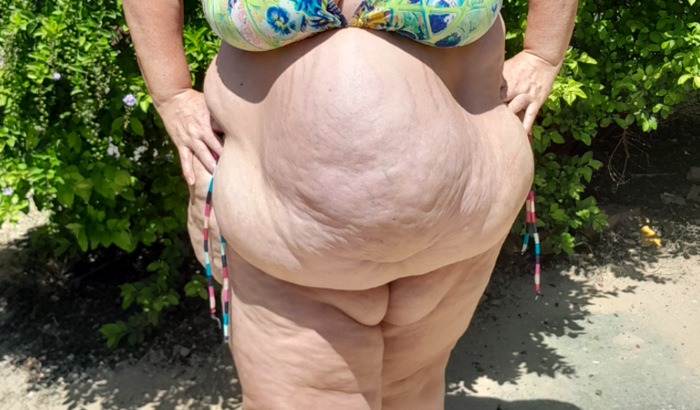 Realizar a bariatrica