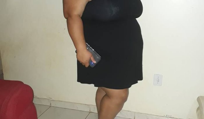 CIRURGIA BARIATRICA DA GREICE