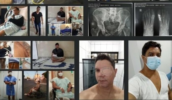 Ajuda para Fabiano Campos - portador de E.A.