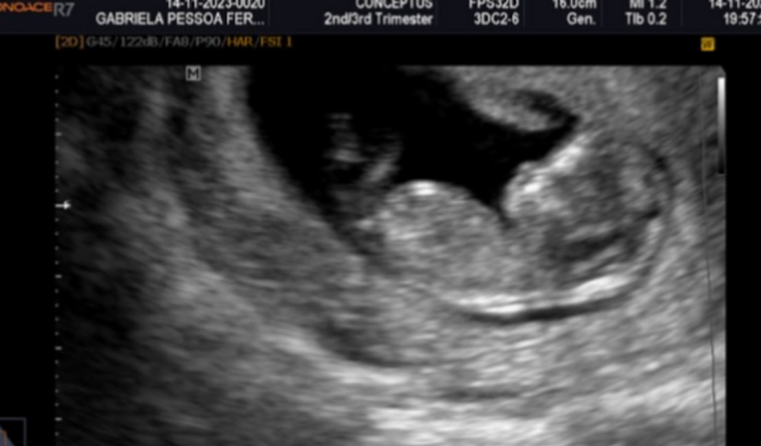 Chá Revelação Gabi e Léo 👦🏻 x 👧🏻