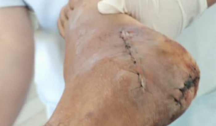 Ajuda pra um tratamento de fisioterapia