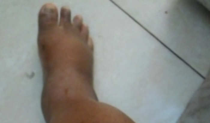 AJUDA PARA TRATAMENTO COM REUMATOLOGISTA NÃO ESTOU CONSEGUINDO ANDAR.