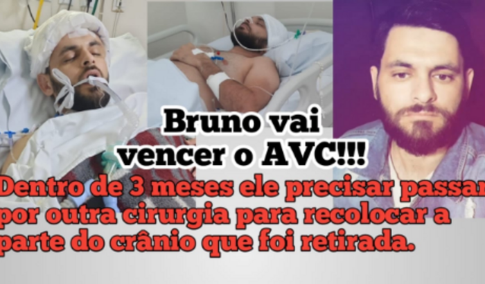 BRUNO VAI VENCER O ACV!!!