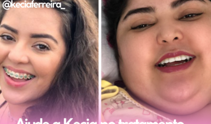 Ajude a Kecia no tratamento paliativo de câncer cerebral