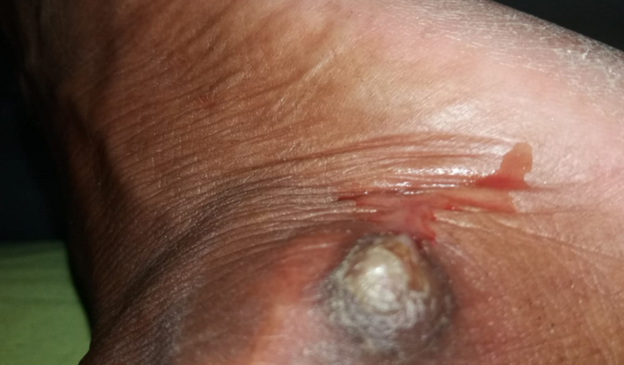 Ajude a Vana a voltar para sua terra, para operar sua perna