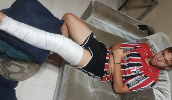 Ajuda para cirurgia e fisioterapia do Joelho