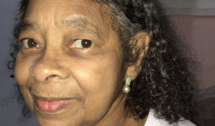 Cirurgia Catarata olho esquerdo (FACO+LIO OE) Maria Fernandes