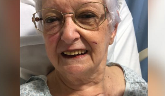 Cuidados pós operatórios com Carmen Lucia