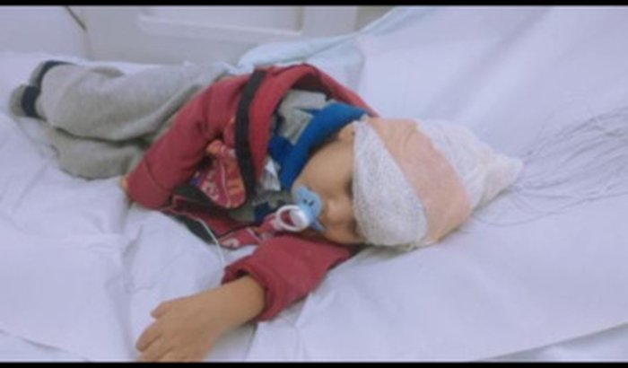 Tratamento de hadryan Gabriel