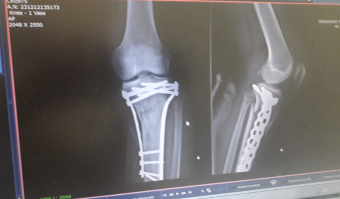 AJUDA PARA ATLETA BJJ