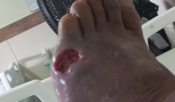 Conserto do Carro de Trabalho