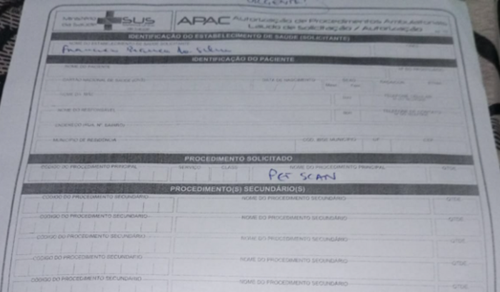 Exame para tratamento de câncer pulmão