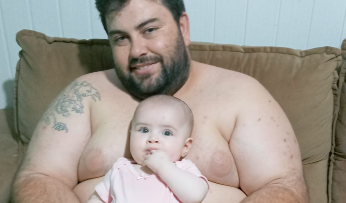 Ajude fazer bariátrica