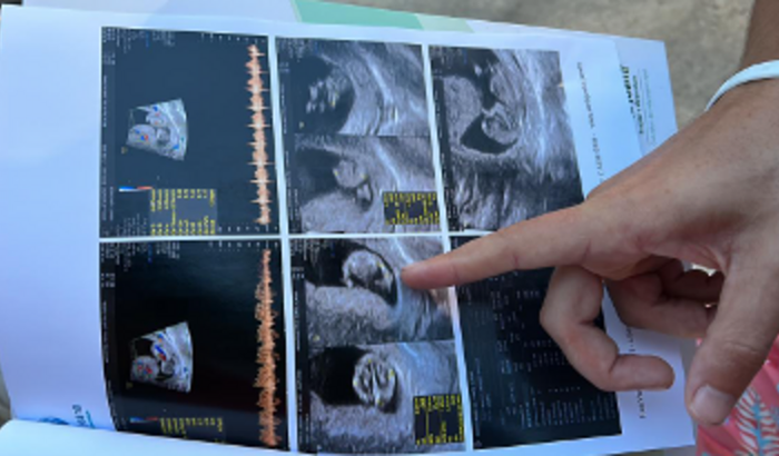 Lendário 💚 ou Lendária 💜