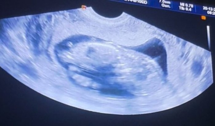 Ajudar na gestação 