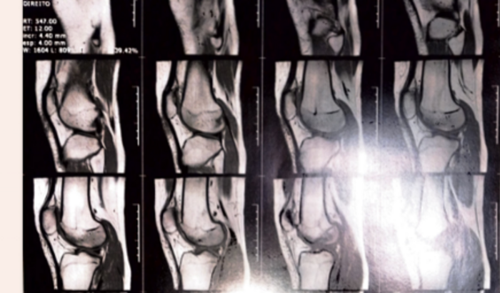 Ajuda para fazer cirurgia nos joelhos urgente 