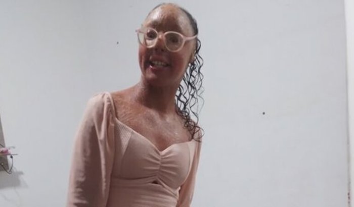 Realizer o sonho da vitória 