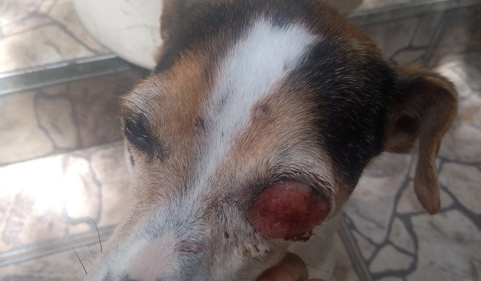 Remoção de Tumor