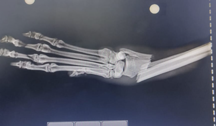 Cirurgia de Caramelo