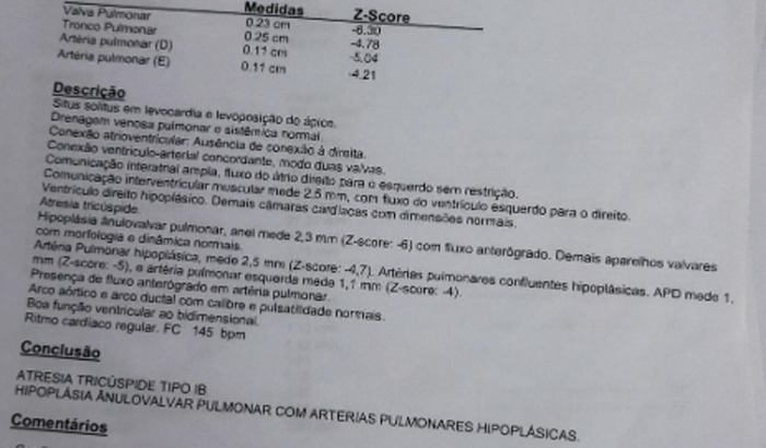 Cardiopatia congênita