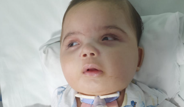 Ajudando o Bernardo