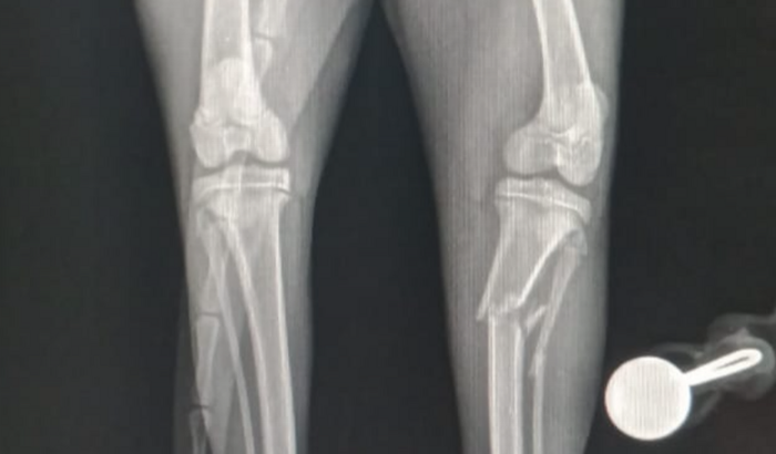 Cirurgia da gata luna