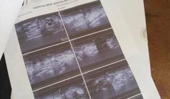 Ajudar na saúde tenho câncer 