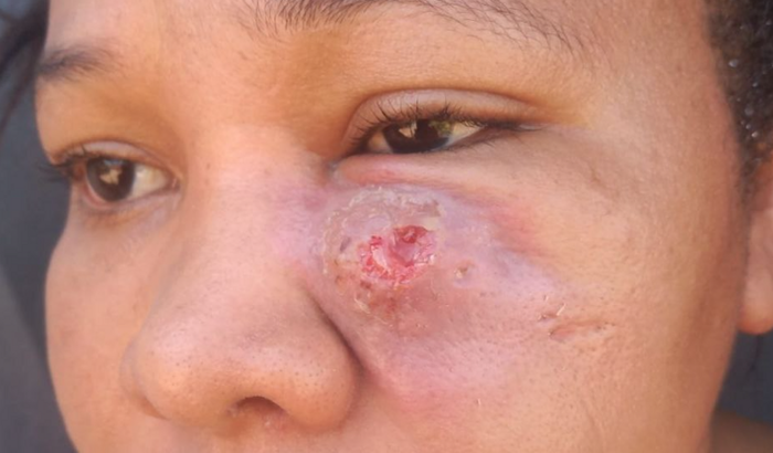 Ajuda solidaria a irmã Sena