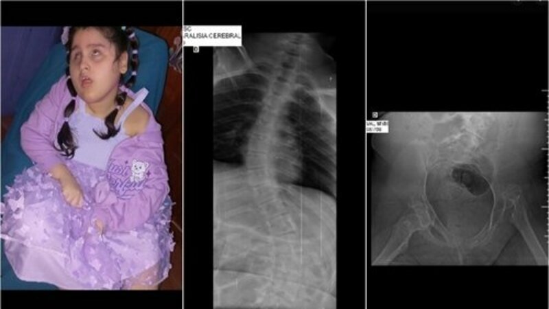 AJUDE NO TRATAMENTO DA SOFI