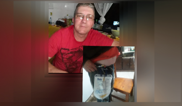 Ajuda para cirurgia de próstata/raspagem.