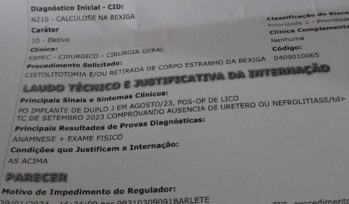 RETIRAR CATETER DUPLO J