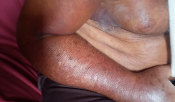 Ajude o Eronildes Ferreira a realizar cirurgia