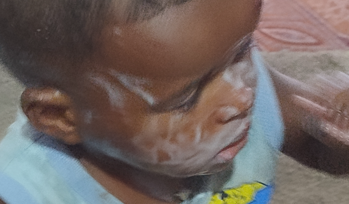 Vaquinha da provisão 